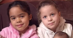 These Are The Rarest Twins On The Planet. WHY? This Is AMAZING! – Viral ...